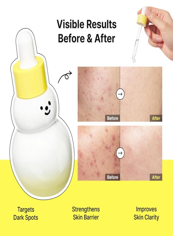 TIA'M TIAM Vita B3 Source Serum Snowman, 10% Niacinamide Glow Serum with 2% Arbutin for Dark Spots, Uneven Skin Tone, Fast-Absorbing, Vegan Korean Skincare -1.35 fl oz (40ml) - Image 3