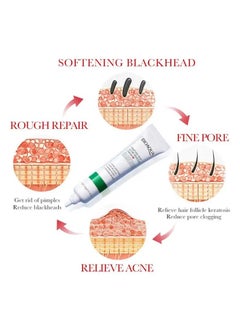 BIOAQUA Salicylic Acid Acne Removal Cream , Acne Treatment Face Cream, Acne Spot Treatment for Face & Acne Dots, Natural Cystic Acne Treatment, For All Skin Types, Premium Acne Scar Cream & Pimple Remover 20g  - Image 4