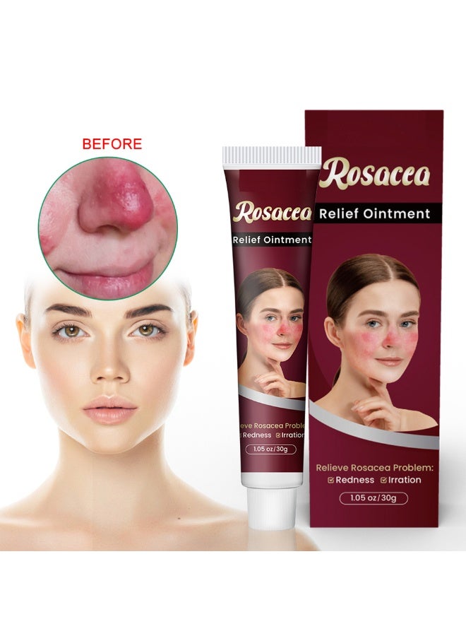 Rosacea Care كريم مرطب للوجه معزز بالفيتامينات للبشرة الحساسة لتخفيف الاحمرار والتهيج في زجاجة شكل شمعي - Image 1