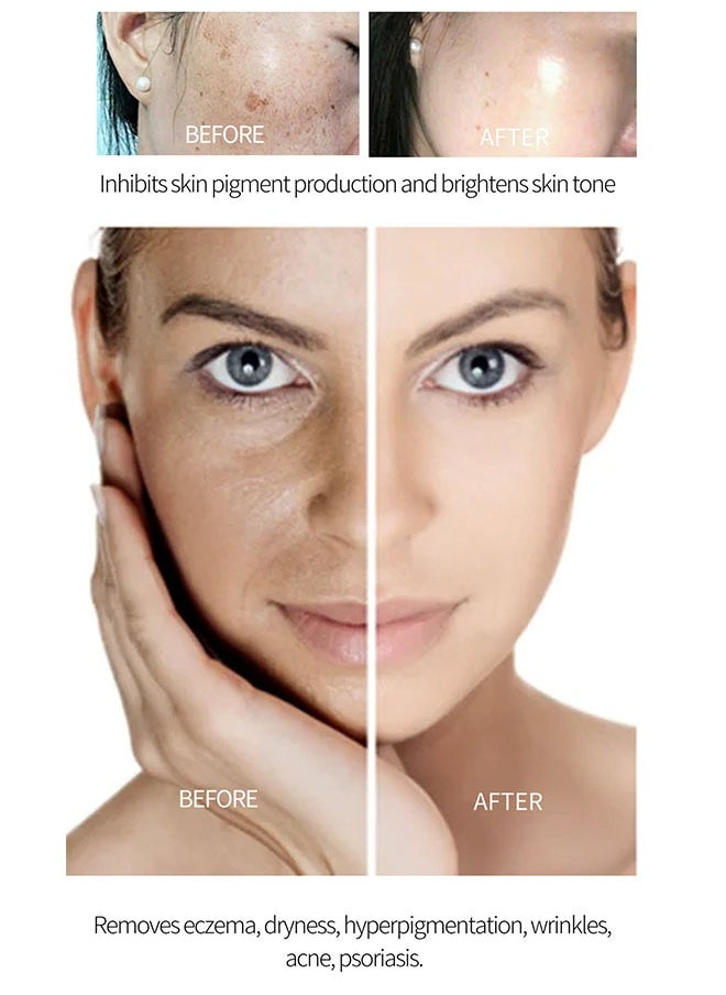 Lanthome - Glutathione Whitening Cream 20g, Intensive Lightening, Facial Dark Spots Remover, Face Moisturizer, Moisturizing and Brightening Tone Up Cream, Skin Lightening Cream with Kojic Acid - Image 1