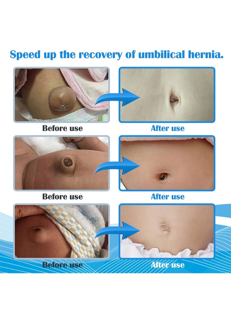 Baby Belly Band Umbilical Hernia Belt Belly on Band Navel Truss Wrap for Newborn Infant Soft, Skin-friendly, Adjustable - Image 5