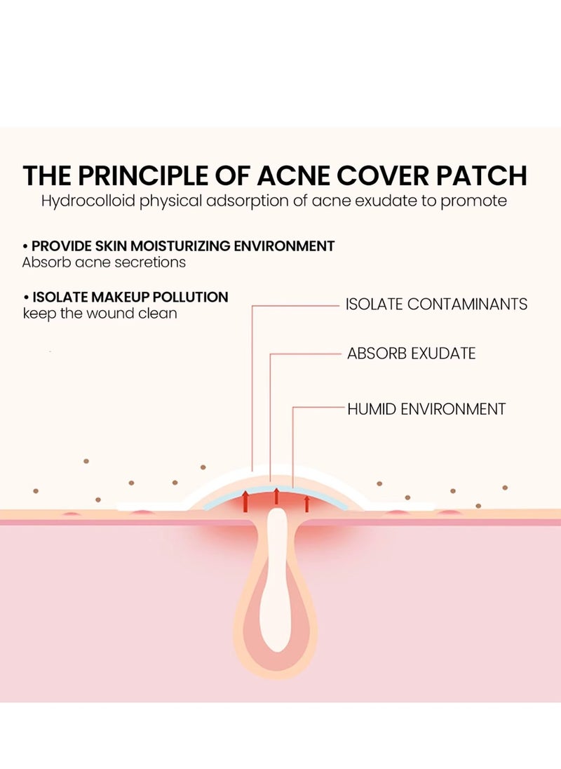Jaysuing - 200 Pcs Pimple Patches Hydrocolloid Non Drying Acne Patches for Face Colorful Star Pimple Spot Sticker with Hyaluronic Acid Tea Tree Oil and Centella Oil Pimple Patches for Covering Blemishes and Zits - Image 1