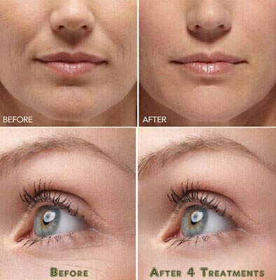 leeposh Hyaluronic Acid powder Lowest Molecular size Below10 Kda Hyaluronic Better penetration in skin layers 20gm Hyaluronic powder - Image 3