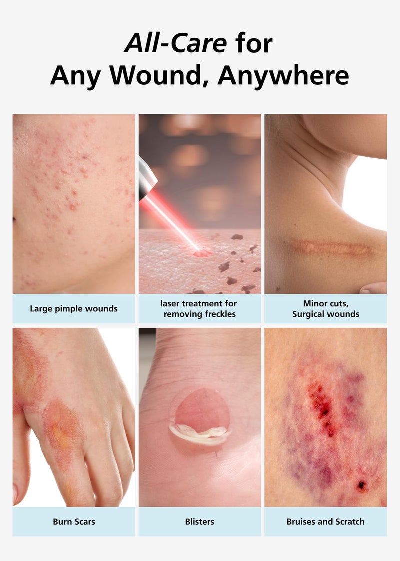 DWEasyDerm ضمادة جروح هيدروكوليد رقيقة من إيزي ديرم 4â€x4â€ عبوة واحدة (2 ضمادات) | مقاومة للماء، خالية من اللاتكس، ضمادة عالية الامتصاص للحروق، الفقاعات، شفاء الجروح مع مقص صغير - Image 4