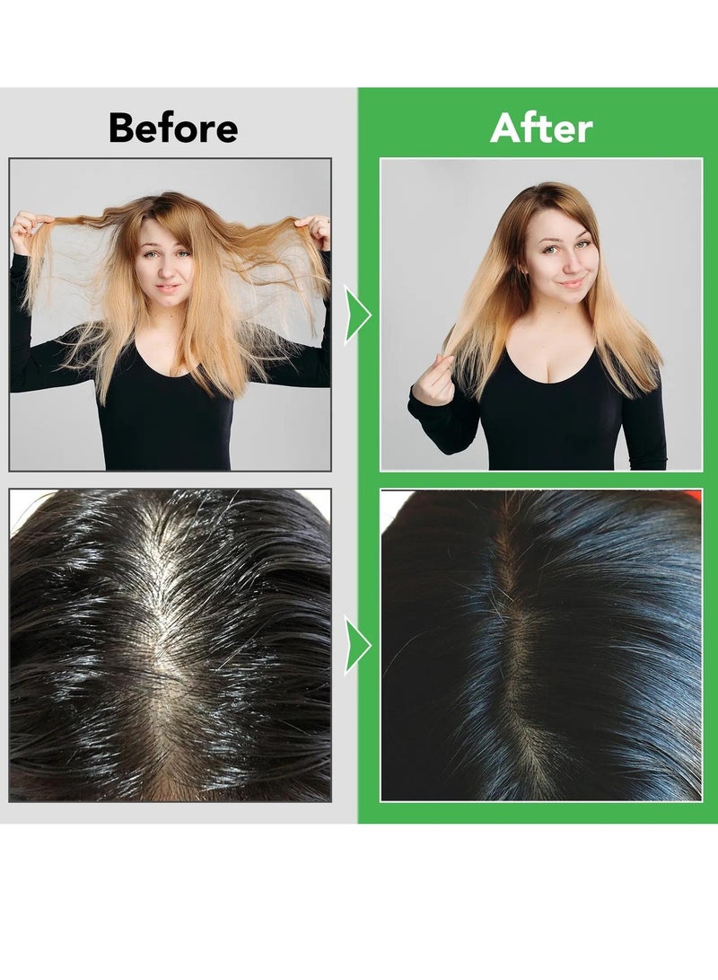 300ml Rosemary Strengthening Conditioner Hair Conditioner with Coconut and Olive Biotin Infused Conditioner Nourishes Moisturizes Strengthens Healthy Scalp Promote Hair Growth Rosemary Conditioner