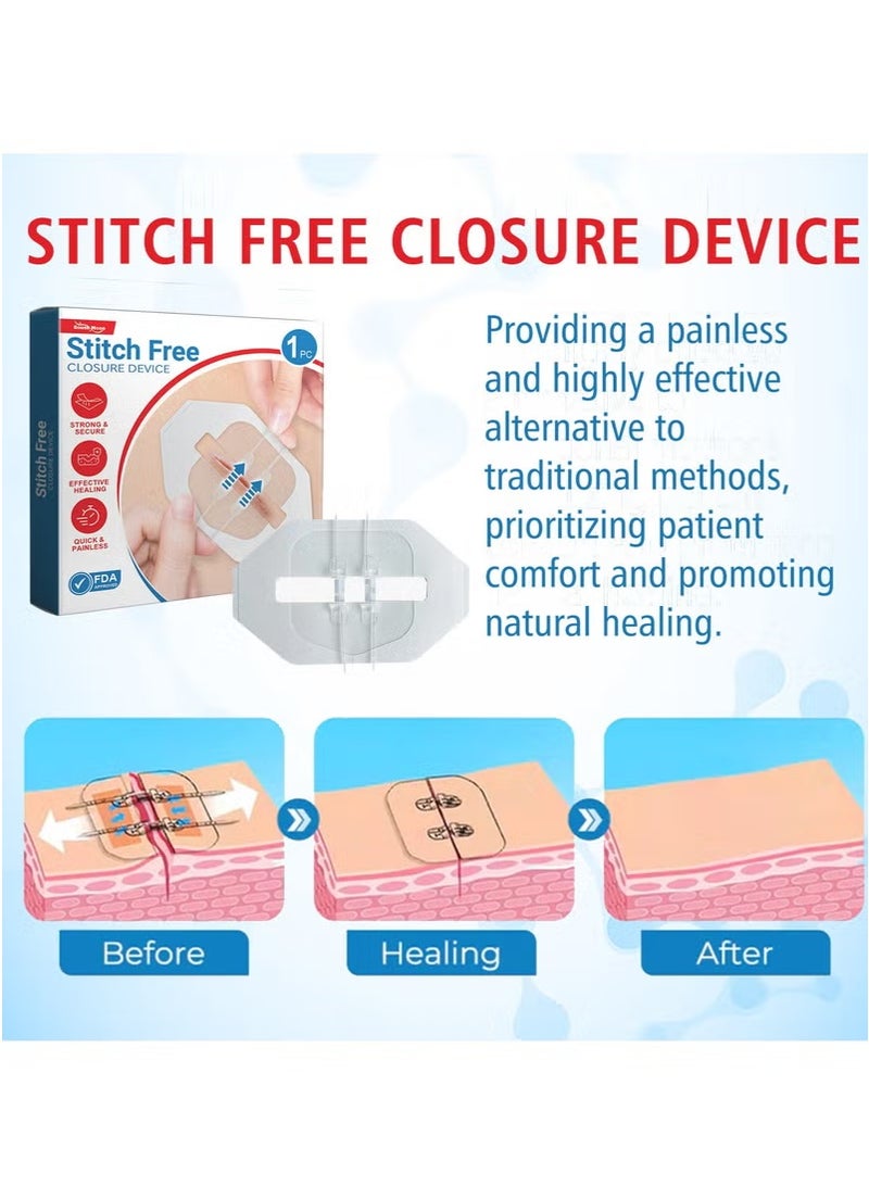 SOUTH MOON South Moon No-Suture Closure Band-Aid Skin Wound Care Band-Aid No-Suture - Image 2