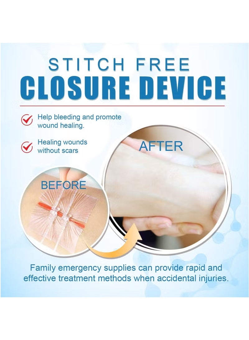 SOUTH MOON South Moon No-Suture Closure Band-Aid Skin Wound Care Band-Aid No-Suture - Image 3