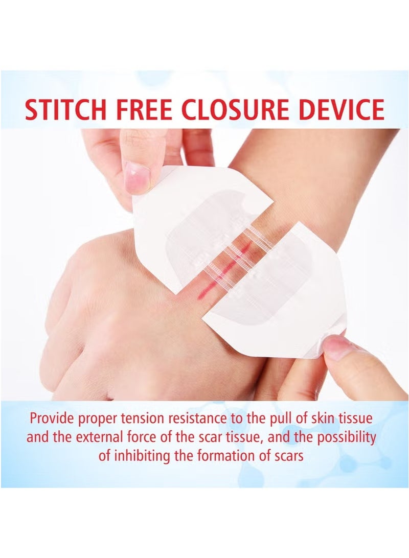 SOUTH MOON South Moon No-Suture Closure Band-Aid Skin Wound Care Band-Aid No-Suture - Image 4