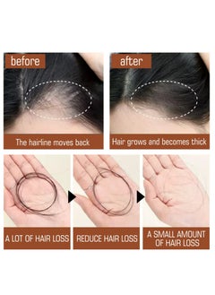 EELHOE Batana Oil, Batana Oil For Hair Growth , Organic Batana Oil For Healthy Hair, Hair Butter with 100% Pure Raw Batana Oil, Batana Oil Hair Treatment, Promotes Hair Strength & Resilience  - Image 2
