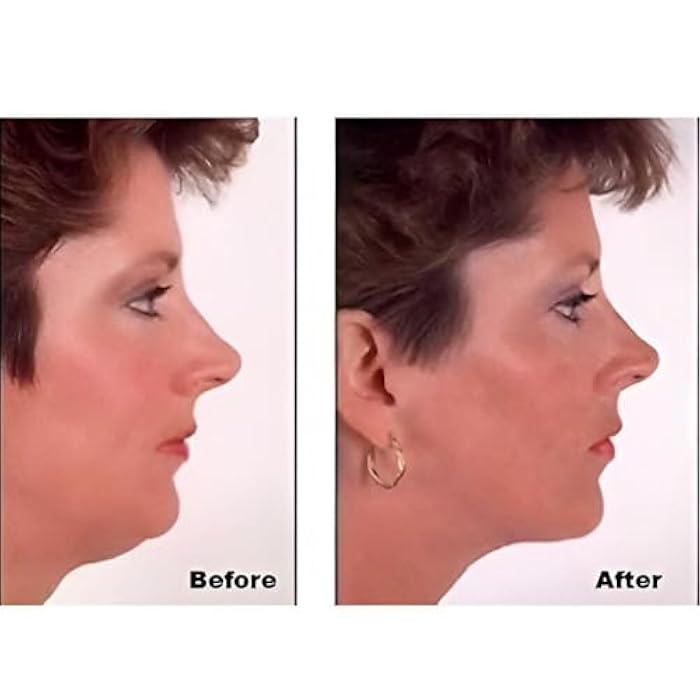 Firming Sagging Areas & Reduce Wrinkles in Face, Neck and Eye Area. Comes with 40 Patches and 3 Wire Strips for Easy and Sustainable Application. - Image 4