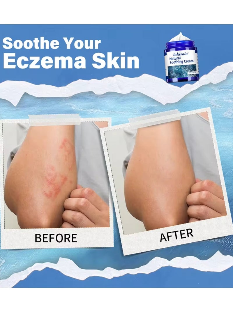 100ml Natural Soothing Cream Hydrating Healing Antibacterial Cream for Psoriasis Eczema Reduce Redness Dryness Moisturizing Soothing and Nourishing Cream with Aloe Vera Niacinamide Face Moisturizing Body Lotion Face Cream