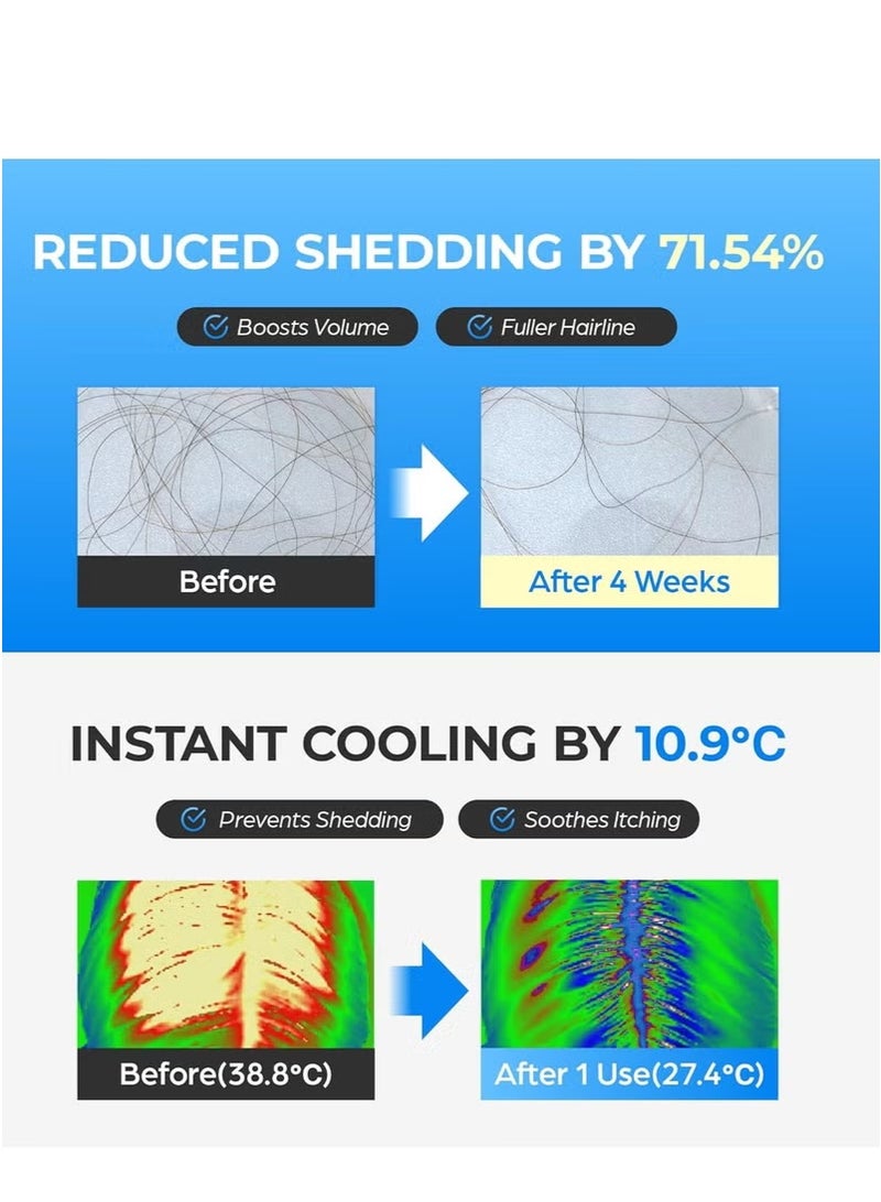 2-PACKS Topical Hair Growth Treatment with Scalphy Viral Effect for Hair Loss, Thinning and Retrieving Hairline,Scalp Massager with Cooling Roller Ball for Men and Women,Hair Regeneration 20g*2 - Image 5