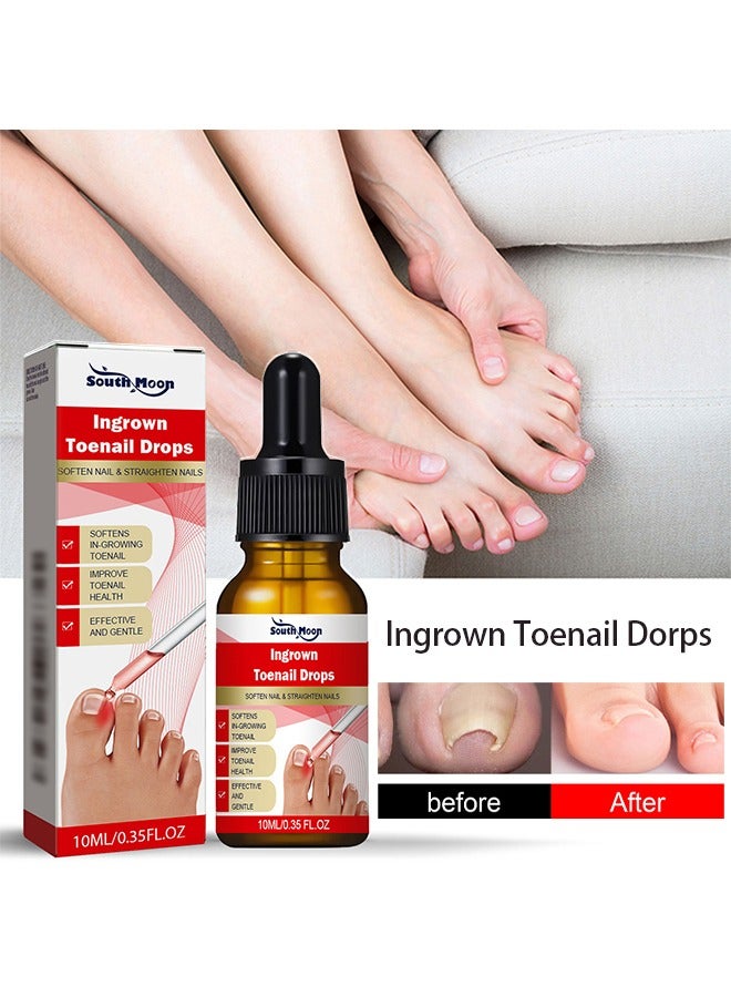SOUTH MOON Ingrown Toenail Drops,Soften Nail & Straighten Nails，Easy Trim Ingrown Toenail Tools,Ingrown Toenail Reliever and Softener 30ML - Image 1