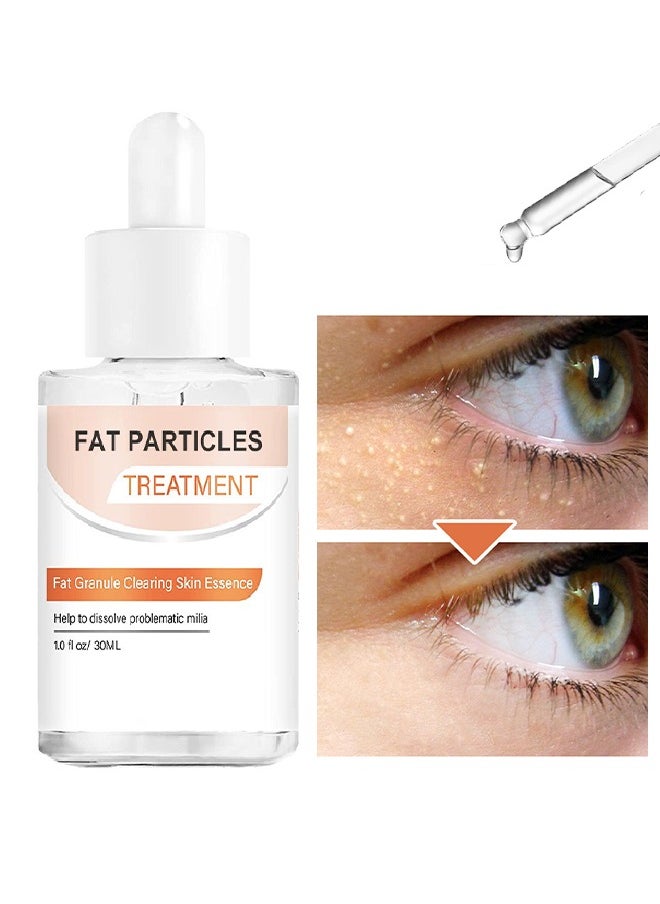 OUHOE - Fat Granule Clearing Skin Essence-Milia Removal Treatment, Milia Spot Treatment Helps Dissolve And Reduce Milia, Whitehead And Sebaceous Hyperplasia, Cysts And Sebaceous Hyperplasia Face Serum 30ml - Image 1