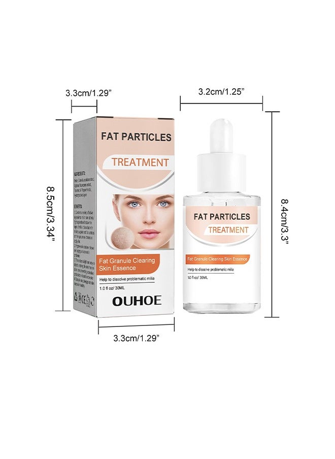 OUHOE - Fat Granule Clearing Skin Essence-Milia Removal Treatment, Milia Spot Treatment Helps Dissolve And Reduce Milia, Whitehead And Sebaceous Hyperplasia, Cysts And Sebaceous Hyperplasia Face Serum 30ml - Image 1