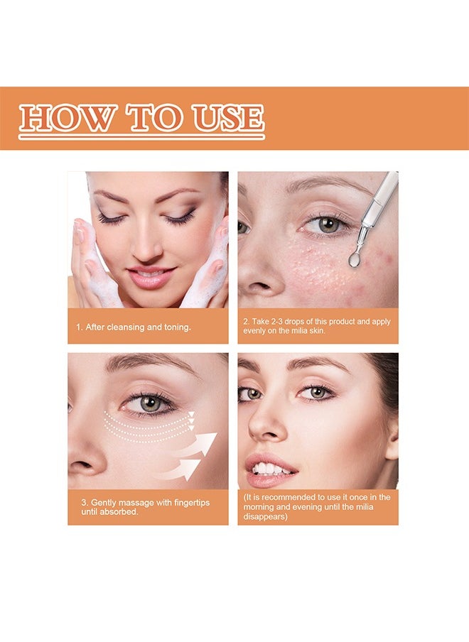 OUHOE - Fat Granule Clearing Skin Essence-Milia Removal Treatment, Milia Spot Treatment Helps Dissolve And Reduce Milia, Whitehead And Sebaceous Hyperplasia, Cysts And Sebaceous Hyperplasia Face Serum 30ml - Image 1