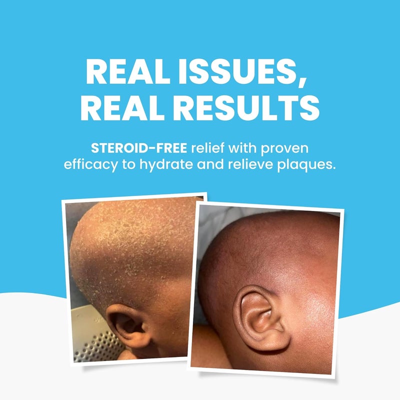 Grahams Natural زيت الإكزيما للأطفال زيت الاستحمام زيت الجسم للأعمار من 0 شهر إلى 12 سنة تركيبة مثبتة سريرياً تخفيف لطيف للبشرة الجافة جداً والحكة 338 أونصة - Image 3