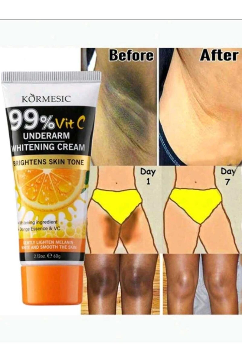 Kormesic كريم تبييض بنكهة البرتقال ٦٠ غرام، لتفتيح الإبطين والمرفقين والركبتين والمفاصل، يرطب وينعش - Image 1