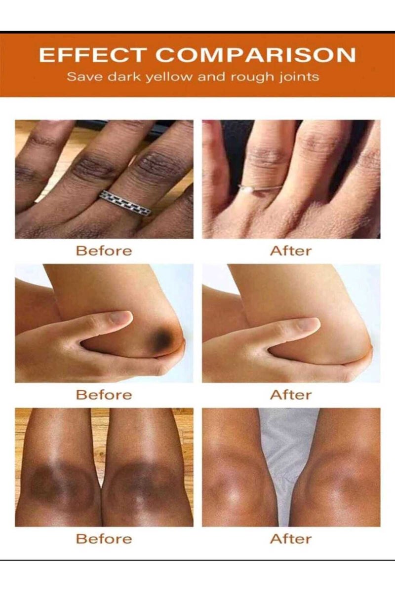 Kormesic كريم تبييض بنكهة البرتقال ٦٠ غرام، لتفتيح الإبطين والمرفقين والركبتين والمفاصل، يرطب وينعش - Image 2