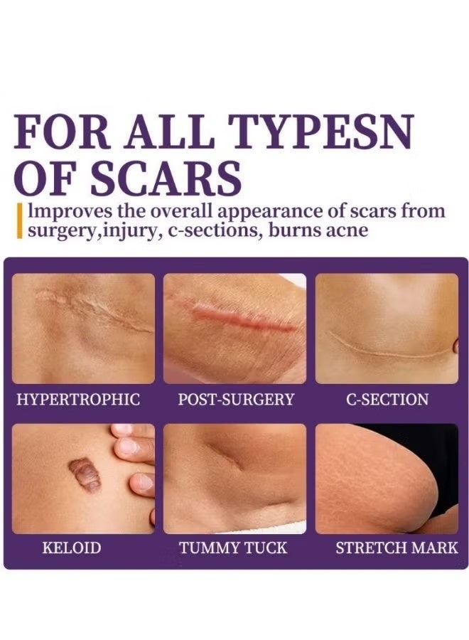 HBESTY Silicone Scar Gel - Scar Care Cream - Acne Mark Skin Care Gel - Lightweight Non Greasy Gel For Face And Body - Image 4