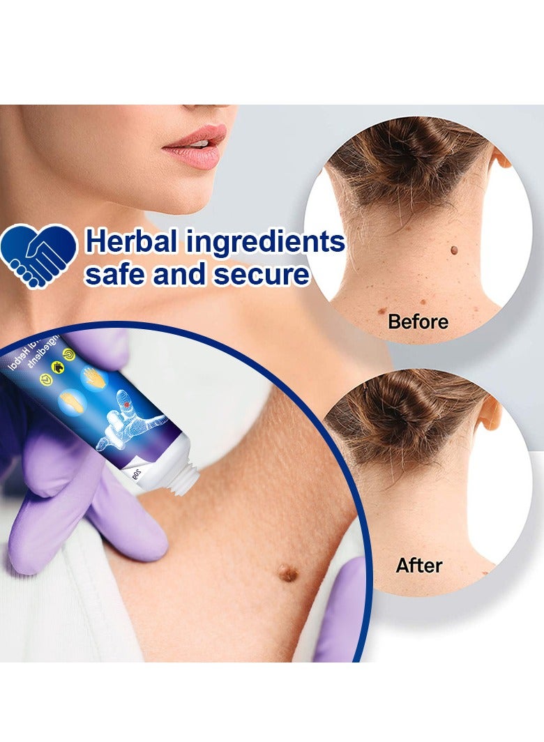 سوميفون 3 قطع لإزالة الثآليل والشامات وتنعيم البشرة - Image 3