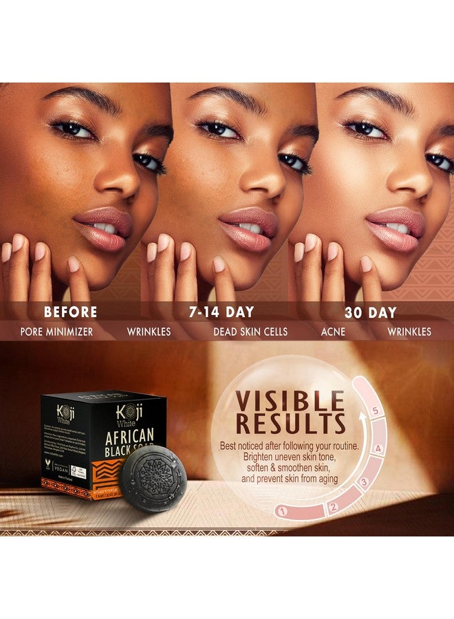 koji white African Black Soapfacial Exfoliant For Blackheads Brightening & Moisturizing Skin With Kojic Acid Shea Butter Aloe Vera For Glowing Skinvegan Parabenfree 2.82Oz (2 Bars)  - Image 5