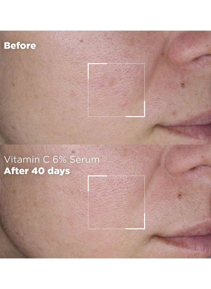 SKIN REPUBLIC - Vitamin C 6% Brightening Face Serum, Helps Reduce Pigmentation and Dark Spots, Provides Long Lasting Hydration (30ml) - Image 1