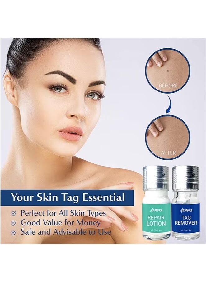 ASMOXA Wart Removal Ointment, Gentle And Safe Portable Wart Removal Ointment With Natural Extracts, Natural Safe and Easy to Use - Image 2