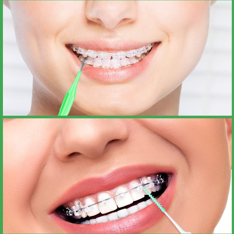 Zopeal 250 Pieces Braces Flossers Interdental Brush for Cleaner Tooth Toothpick Dental Teeth Flossing Picks Head Oral Dental Hygiene Cleaning Tool Soft Cleaners - Image 4