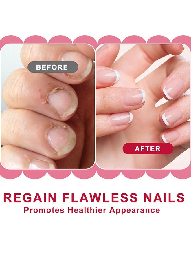 سوميفون كريم منعم بشرة الأظافر ، جلد الأظافر الميت ، كريم تليين ، ظفر الإصبع ، كريم إصلاح ، مانيكير 20 جرام - Image 4