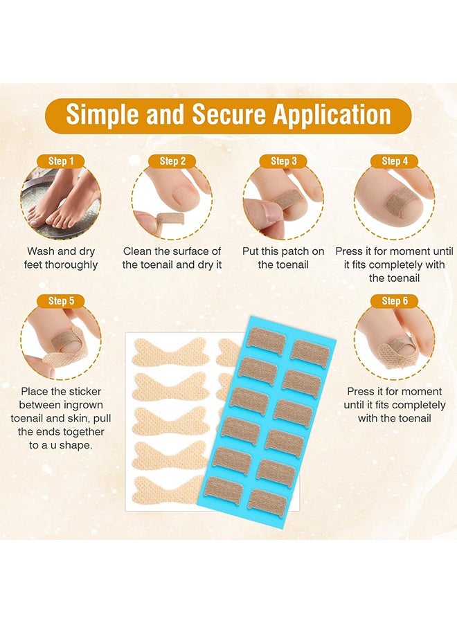 60pcs Ingrown Toenail Corrector Patch and 50pcs Ingrown Toenail Strips Breathable Ingrown Toenail Stickers Tape for Toenail Treatment Pain Relief and Correction - Image 5