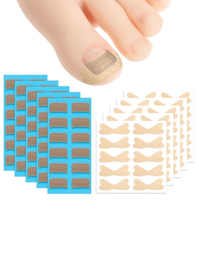 60pcs Ingrown Toenail Corrector Patch and 50pcs Ingrown Toenail Strips Breathable Ingrown Toenail Stickers Tape for Toenail Treatment Pain Relief and Correction - Image 1