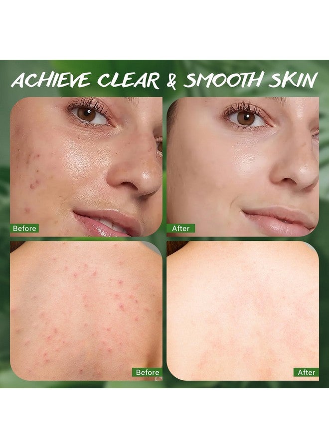 POP MODERN.C Tea Tree Soap Bar for Face & Body Wash Tea Tree Oil Bath Soaps for Athlete's Foot Body Odor Acne Deep Clean Men Women All Skin Types with Mesh Soap Bag 3x100G - Image 5