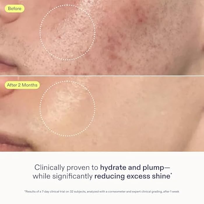 Skinfix جل كريم لإصلاح حاجز البشرة من سكين فيكس - 1.7 أونصة - مرطب غير دهني للبشرة العادية إلى المختلطة - يرطب، ويملأ، وينعم - غير مسد للمسام، خالي من العطور، نباتي، خالي من التجارب على الحيوانات - Image 4