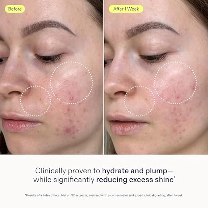 Skinfix جل كريم لإصلاح حاجز البشرة من سكين فيكس - 1.7 أونصة - مرطب غير دهني للبشرة العادية إلى المختلطة - يرطب، ويملأ، وينعم - غير مسد للمسام، خالي من العطور، نباتي، خالي من التجارب على الحيوانات - Image 3