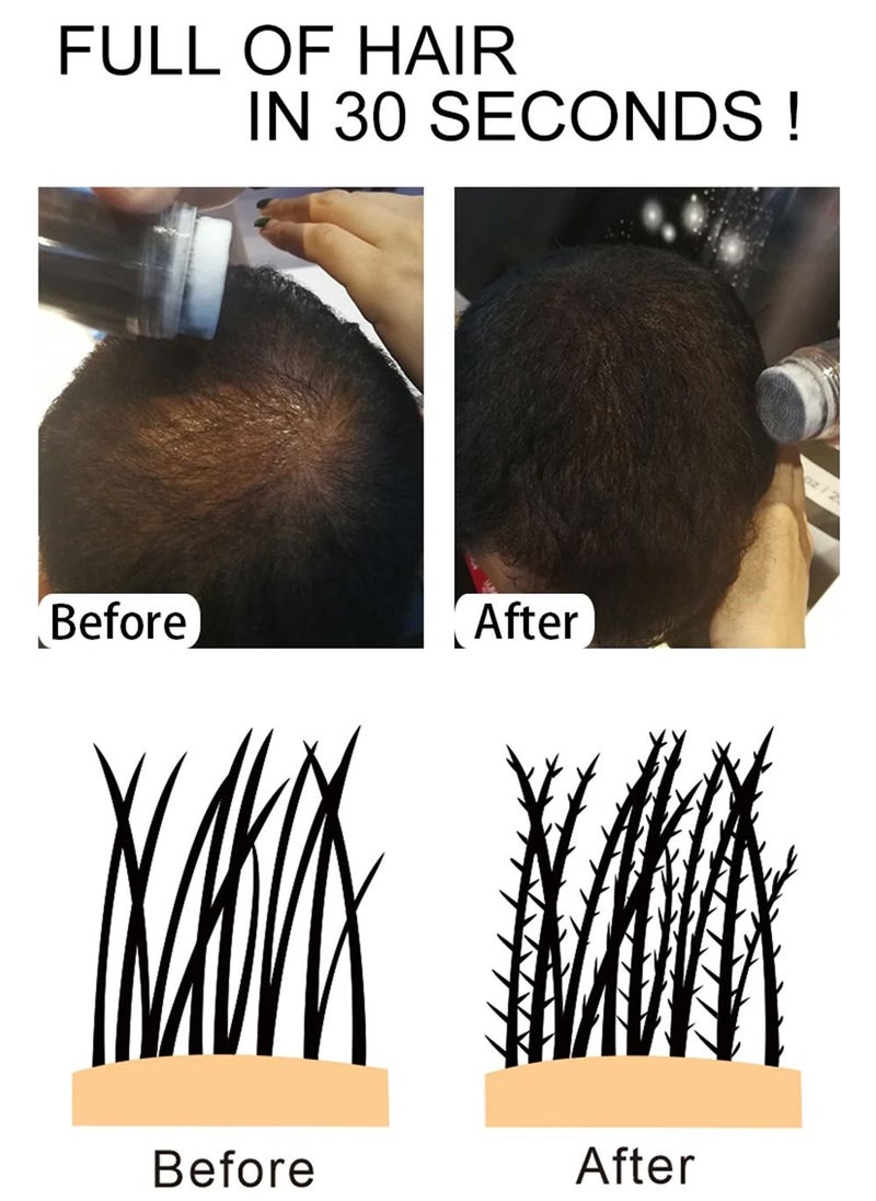 Sevich - Hair Building Fibers Keratin Thicker Anti Hairs Loss Concealer Thickening Fiber Powders Growth Sevich 25G - Image 1