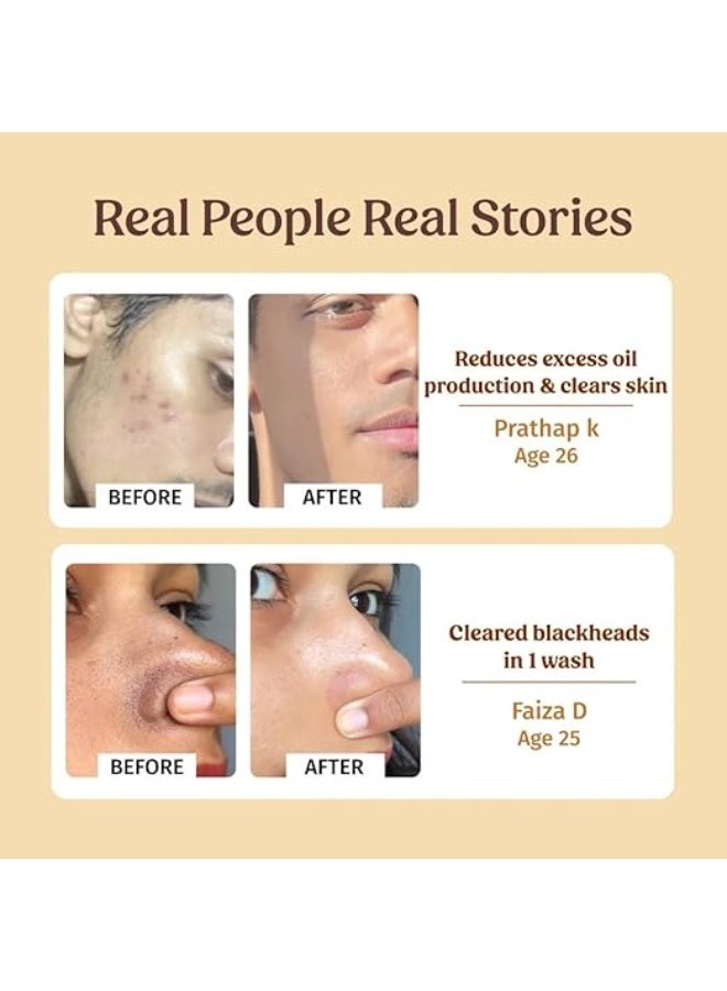 Vilvah STORE Pore Minimising Combo | Powder Face Wash + Milk Toner | Unclogs Pores, Removes Blackheads & Controls Oil | Exfoliates, Hydrates & Refines Skin | For All Skin Types - Image 4