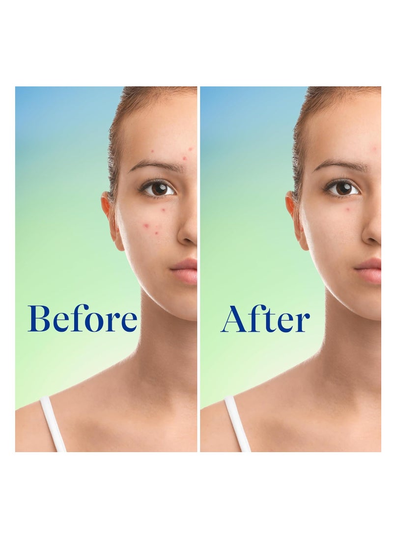 differin - Differin Acne Face Wash with 10% Benzoyl Peroxide, Maximum Strength OTC Acne Foaming Cleanser, Fast Acting Acne Treatment for Face and Body, 5 oz. - Image 1