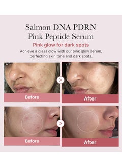 Medicube Medicube Salmon DNA PDRN Pink Peptide Glow Serum with Niacinamide for Hydration, Brightening & Firming – 30ml (Korean Skincare)  - Image 2