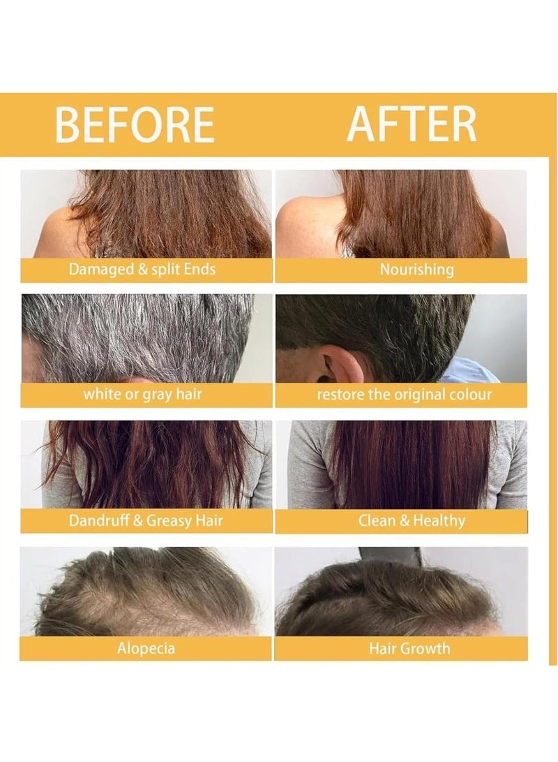 NIKITA.VIVI صابون شامبو الزنجبيل 60 جرام لنمو الشعر مع إكليل الجبل وزيت الزيتون لمنع تساقط الشعر وتقليل القشرة وتخفيف الحكة وتقوية جذور الشعر صابون زنجبيل سوليس - Image 2