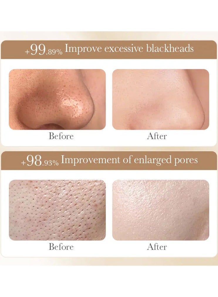 BIOAQUA قناع الطين الخام من بيواكوا برز الأرز للتحكم في الزيت وتنظيف عميق وتفتيح البشرة 120 جرام - Image 4