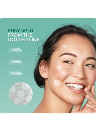 192 CT (4 PK) Hydrocolloid Acne Patches - Pimple Patches for Face, Pimple Patch for Face, Blemish Patches, Zit Patches for Face, Acne Patches for Face, Acne Patch, Pinple Patches, Acne Dots - pzsku/ZA5F289CC78937B743340Z/45/_/1687689016/32df9aea-55da-4d90-b44c-b466501d9771