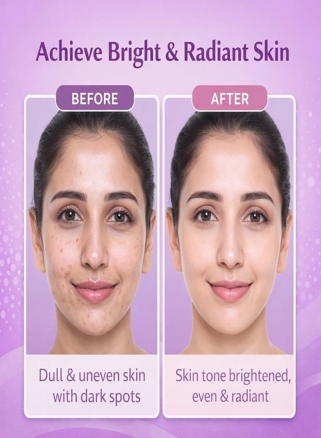 Sanfe BrightShot Skin Radiance Peeling Gel Kit | Pack of 4 | 6-Day Targeted Skincare Routine with Niacinamide, Kojic Acid, Glutathione & Vitamin C | Exfoliates Dead Skin, Brightens Tone, Pore Minimizer & Skin Barrier Support - Image 1