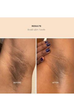 Bushbalm Bushbalm Dark Spot Exfoliating Scrub - Natural Body Scrub Exfoliant to Hydrated, Soften and Enhance Glow in Skin - Bermuda 236 ml  - Image 3