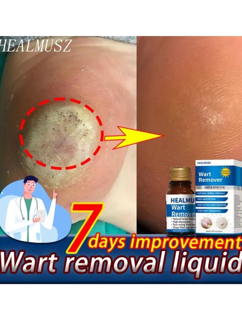 HEALMUSZ Wart Remover Skin Tag Remover Mole Corrector Skin Tag Removal and Repair Lotion Wart and Mole Remover Easy to Use Skin Tag Remover Safe and Effective Easy to use at Home Skin Tag Removal Serum 10ml  - Image 5