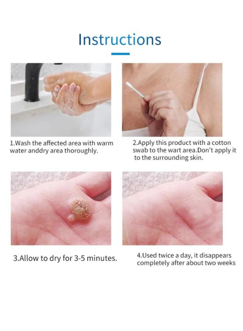 HEALMUSZ Wart Remover Skin Tag Remover Mole Corrector Skin Tag Removal and Repair Lotion Wart and Mole Remover Easy to Use Skin Tag Remover Safe and Effective Easy to use at Home Skin Tag Removal Serum 10ml  - Image 4