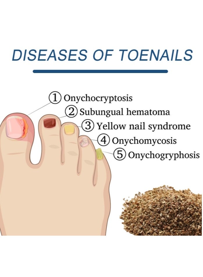 EELHOE 32Pcs Fungal Nail Patches Overnight Nail Repair Patch for Nail Fungus Damage Nail Treatment Renews Nails Structure and Improve Discoloration 8Hrs Nighttime Renewal Fungal Nail Patch - Image 4