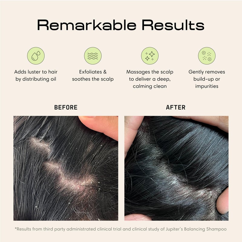 Jupiter Scalp Exfoliator - Scalp Massager Tool for Wet & Dry Hair - Ergonomic Detangler Brush - Dandruff Comb & Scrub to Remove Dandruff & Buildup and Support Circulation - Black/White - Image 2