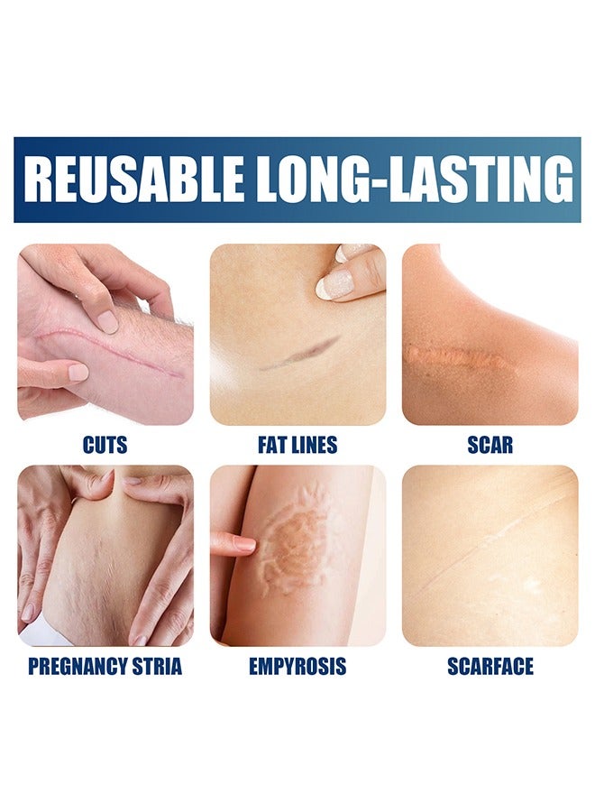 Jaysuing Silicone Scar Gel ,Scar Removal,Scar Treatment, Scar Removal Cream for C-Section, Stretch Marks, Acne, Surgery, Effective for Both Old and New Scars 30g - Image 5