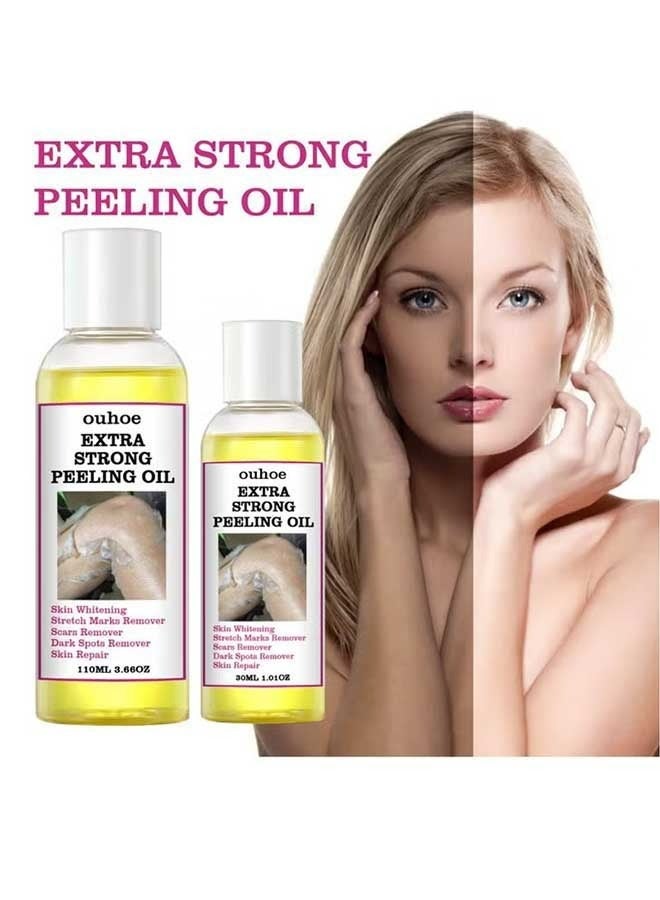 OUHOE 2Pcs Extra Strong Peeling Oil (30ml+110ml), Exfoliate Dark Skin, Super Whiten And Brighten Skin Tone, Exfoliating Peeling Solution for Body All Skin Type  - Image 1